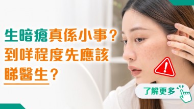生暗瘡真係小事?到咩程度先應該睇醫生? 202505 polyhealth_皮膚科 1200x628